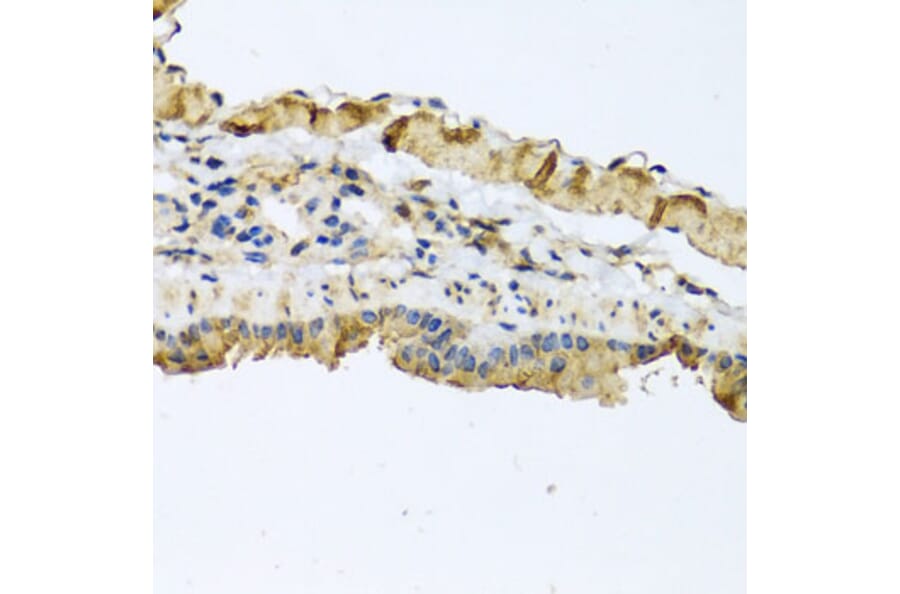 Immunohistochemistry - Anti-ATP2C1 Antibody (A14024) - Antibodies.com