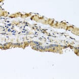 Immunohistochemistry - Anti-ATP2C1 Antibody (A14024) - Antibodies.com