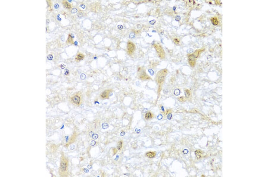 Immunohistochemistry - Anti-ATP2C1 Antibody (A14024) - Antibodies.com