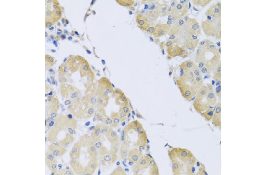 Immunohistochemistry - Anti-ATP2C1 Antibody (A14024) - Antibodies.com