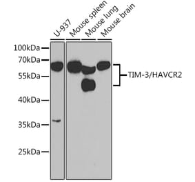 Western Blot - Anti-TIM 3 Antibody (A14025) - Antibodies.com