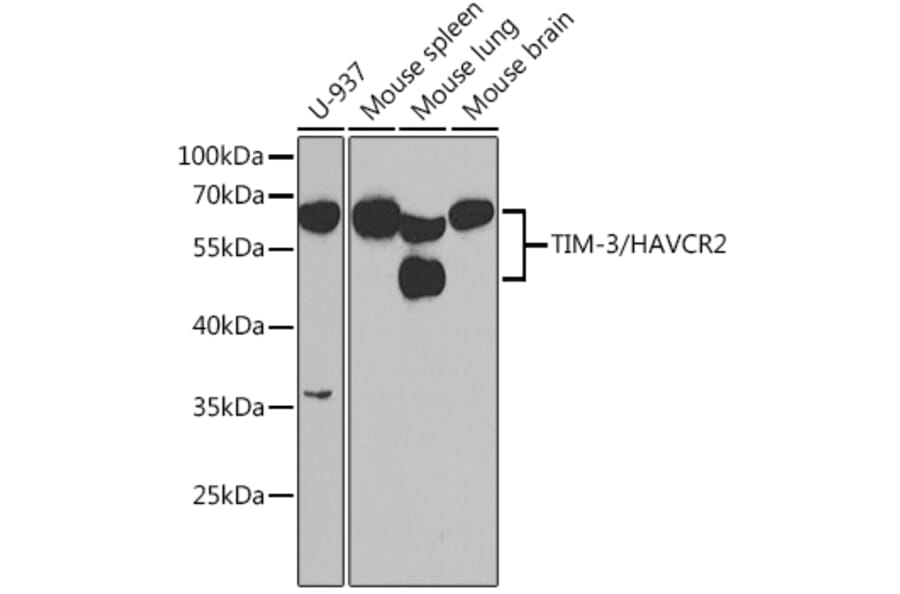 Western Blot - Anti-TIM 3 Antibody (A14025) - Antibodies.com