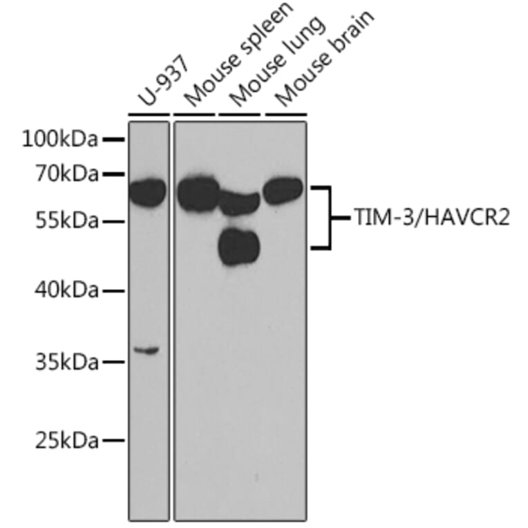 Western Blot - Anti-TIM 3 Antibody (A14025) - Antibodies.com