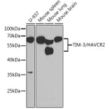 Western Blot - Anti-TIM 3 Antibody (A14025) - Antibodies.com