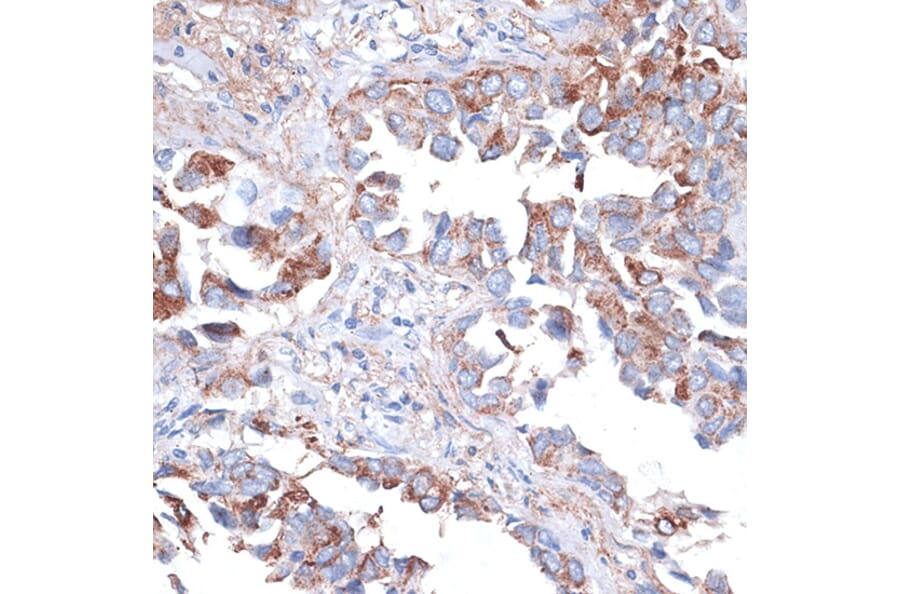 Immunohistochemistry - Anti-TIM 3 Antibody (A14025) - Antibodies.com