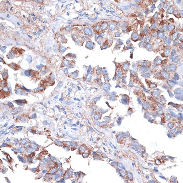 Immunohistochemistry - Anti-TIM 3 Antibody (A14025) - Antibodies.com