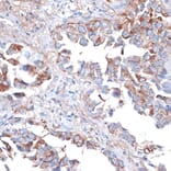 Immunohistochemistry - Anti-TIM 3 Antibody (A14025) - Antibodies.com