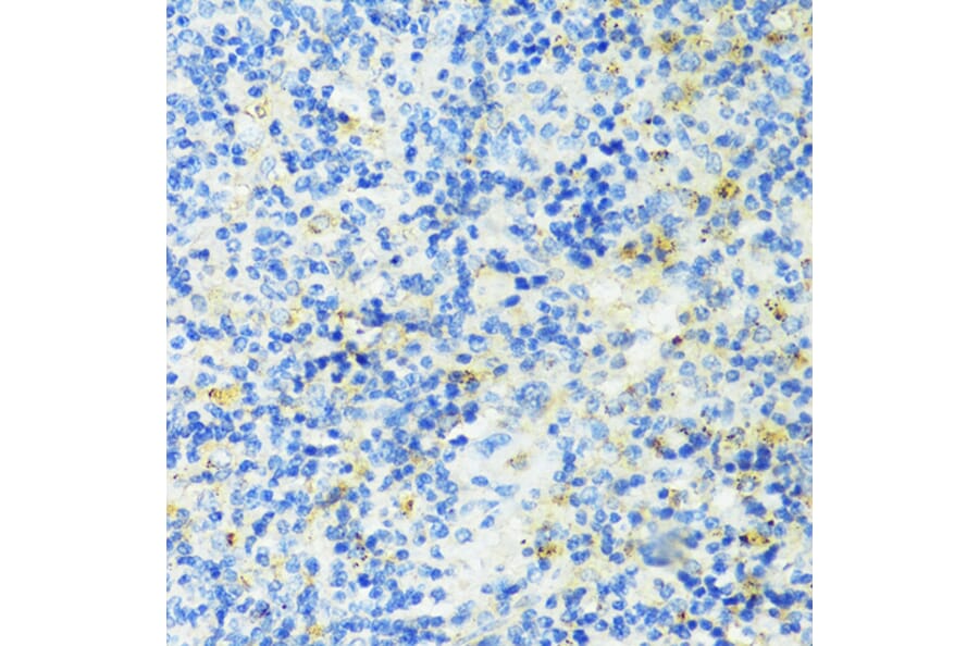 Immunohistochemistry - Anti-TIM 3 Antibody (A14025) - Antibodies.com