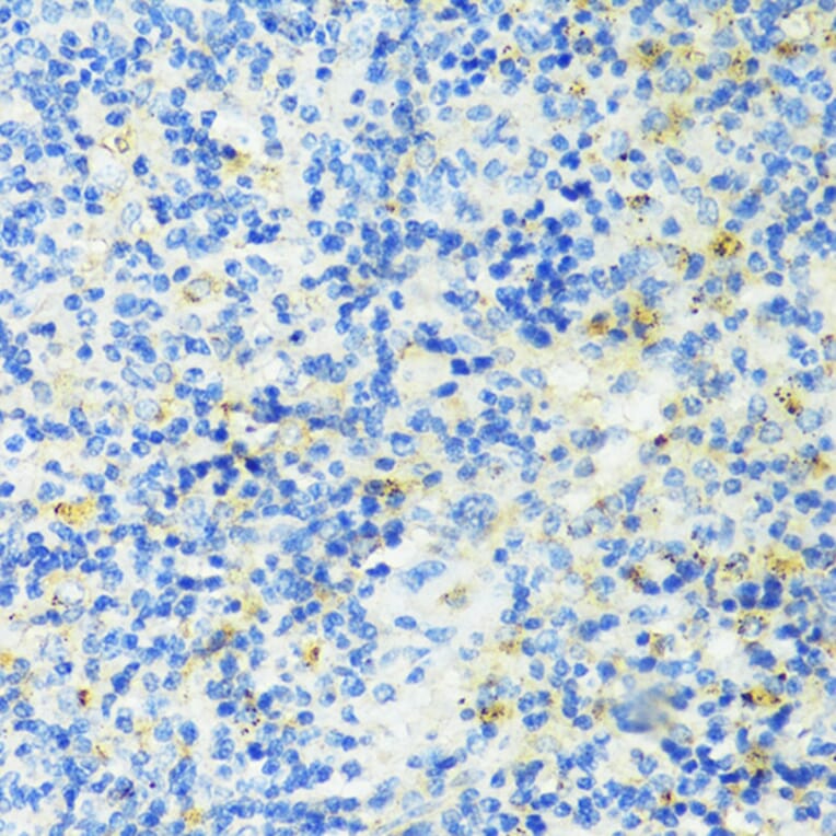 Immunohistochemistry - Anti-TIM 3 Antibody (A14025) - Antibodies.com