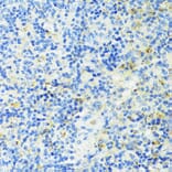 Immunohistochemistry - Anti-TIM 3 Antibody (A14025) - Antibodies.com