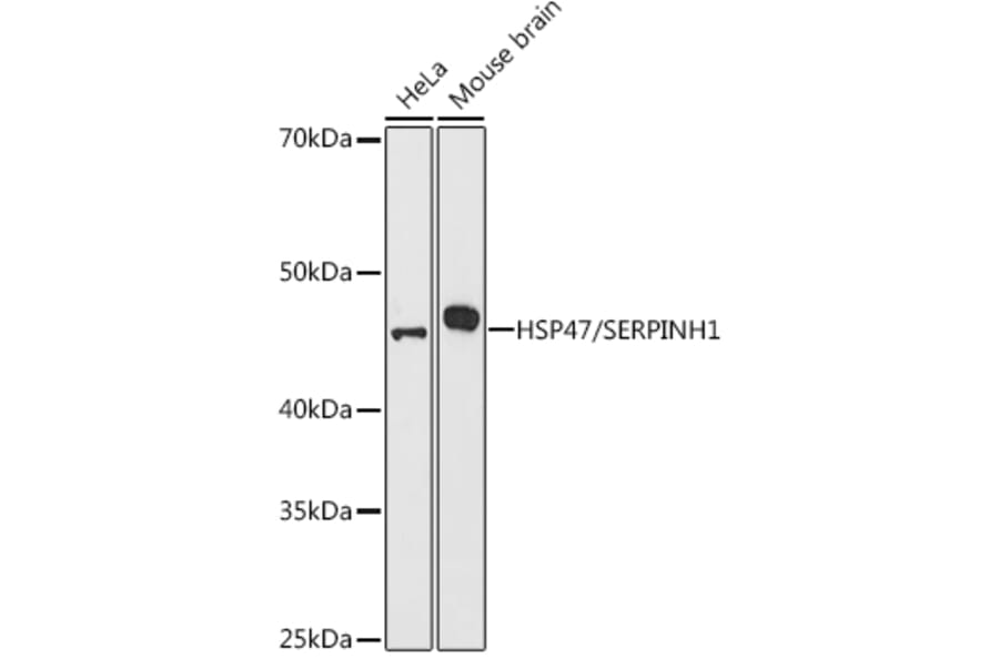 Western Blot - Anti-Hsp47 Antibody (A14026) - Antibodies.com