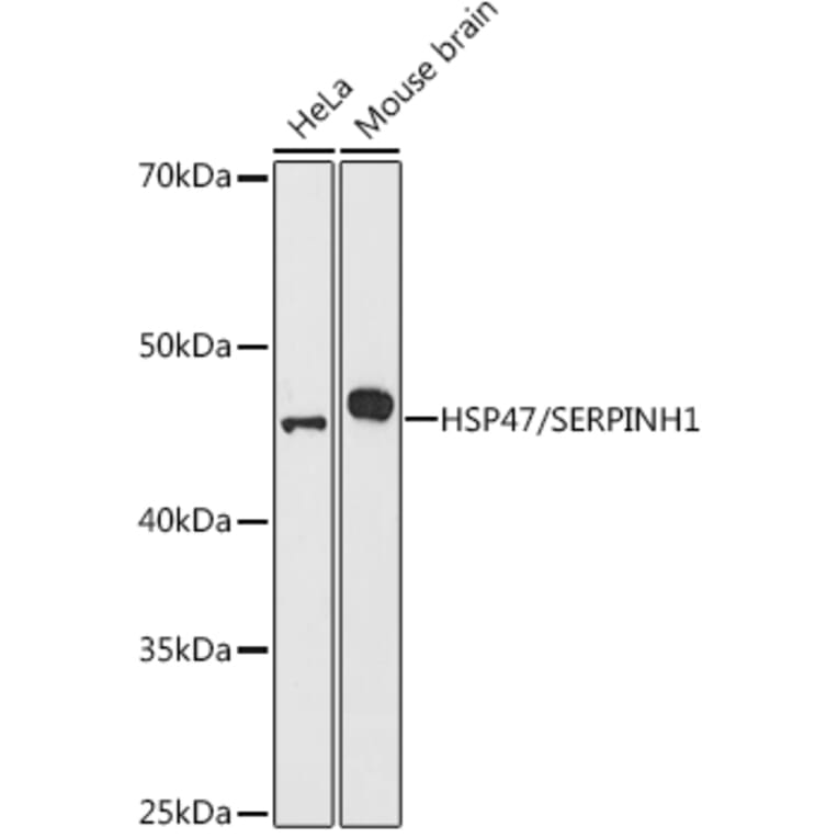 Western Blot - Anti-Hsp47 Antibody (A14026) - Antibodies.com
