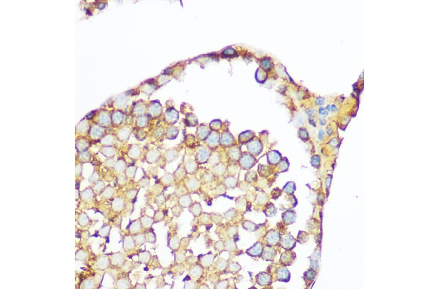 Immunohistochemistry - Anti-Hsp47 Antibody (A14026) - Antibodies.com