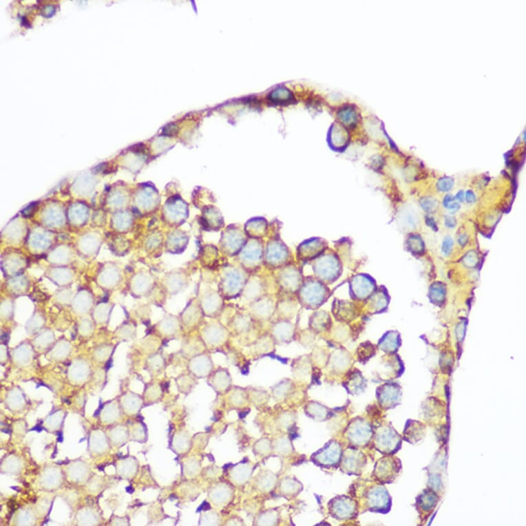 Immunohistochemistry - Anti-Hsp47 Antibody (A14026) - Antibodies.com
