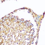 Immunohistochemistry - Anti-Hsp47 Antibody (A14026) - Antibodies.com