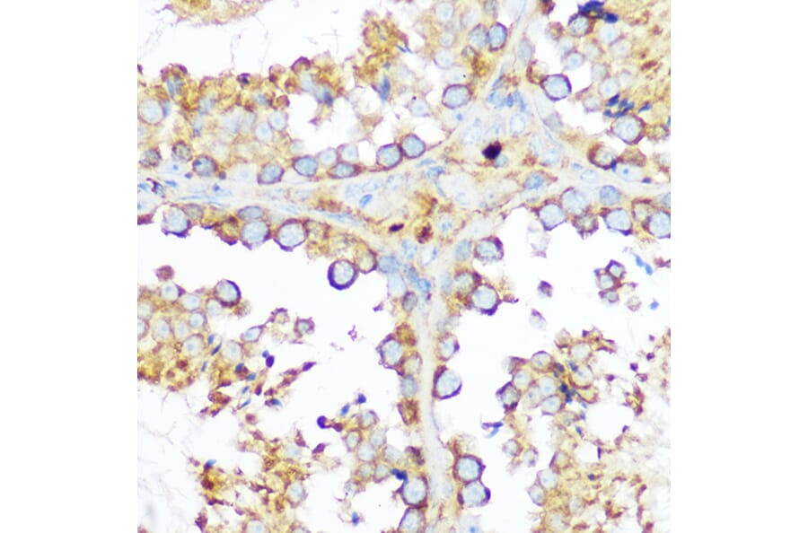 Immunohistochemistry - Anti-Hsp47 Antibody (A14026) - Antibodies.com
