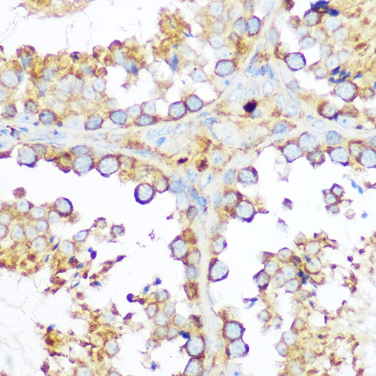 Immunohistochemistry - Anti-Hsp47 Antibody (A14026) - Antibodies.com