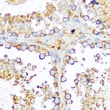 Immunohistochemistry - Anti-Hsp47 Antibody (A14026) - Antibodies.com