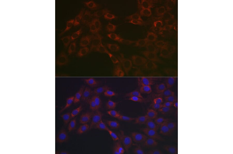 Immunofluorescence - Anti-Hsp47 Antibody (A14026) - Antibodies.com
