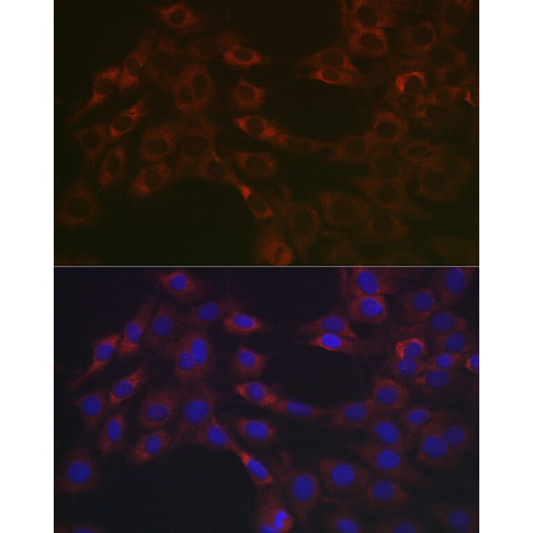 Immunofluorescence - Anti-Hsp47 Antibody (A14026) - Antibodies.com