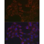 Immunofluorescence - Anti-Hsp47 Antibody (A14026) - Antibodies.com
