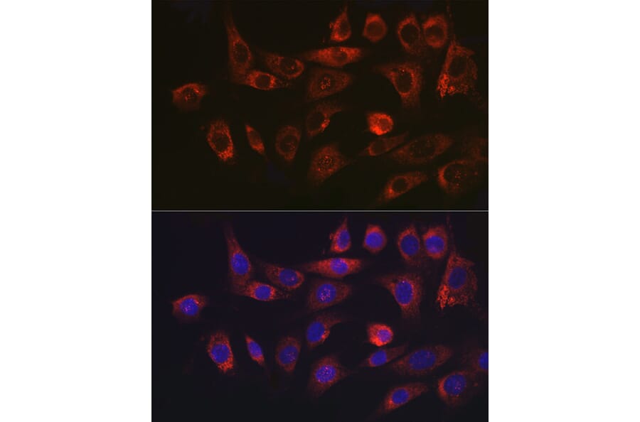 Immunofluorescence - Anti-Hsp47 Antibody (A14026) - Antibodies.com