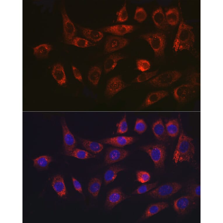 Immunofluorescence - Anti-Hsp47 Antibody (A14026) - Antibodies.com
