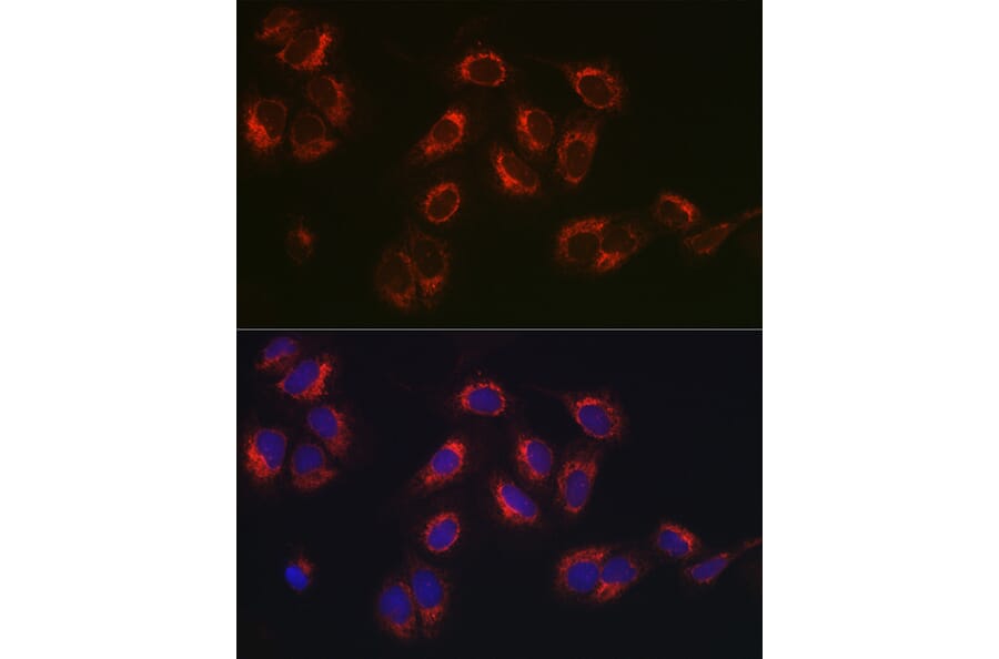 Immunofluorescence - Anti-Hsp47 Antibody (A14026) - Antibodies.com