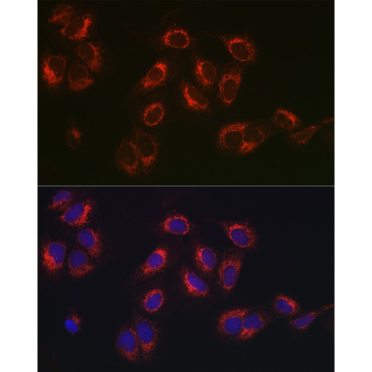 Immunofluorescence - Anti-Hsp47 Antibody (A14026) - Antibodies.com