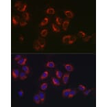 Immunofluorescence - Anti-Hsp47 Antibody (A14026) - Antibodies.com
