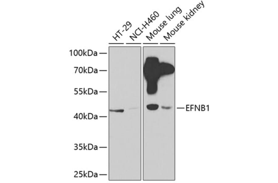 Western Blot - Anti-Ephrin B1 Antibody (A14027) - Antibodies.com