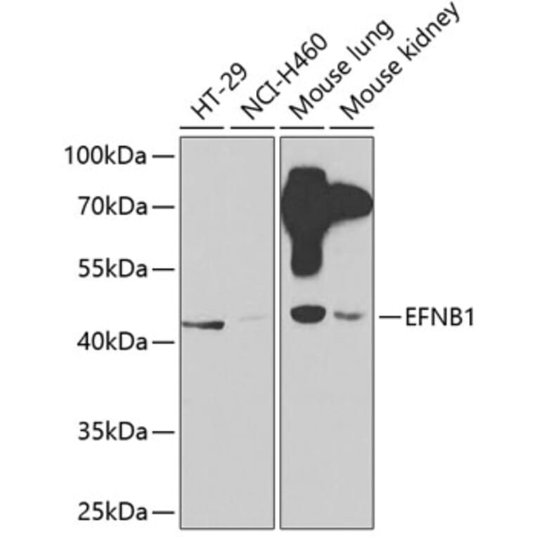 Western Blot - Anti-Ephrin B1 Antibody (A14027) - Antibodies.com