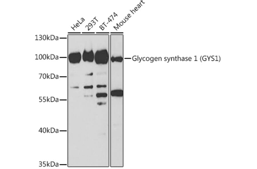 Western Blot - Anti-Glycogen synthase 1/GYS1 Antibody (A14028) - Antibodies.com