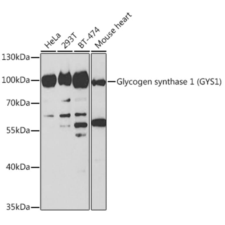 Western Blot - Anti-Glycogen synthase 1/GYS1 Antibody (A14028) - Antibodies.com