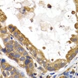 Immunohistochemistry - Anti-Glycogen synthase 1/GYS1 Antibody (A14028) - Antibodies.com