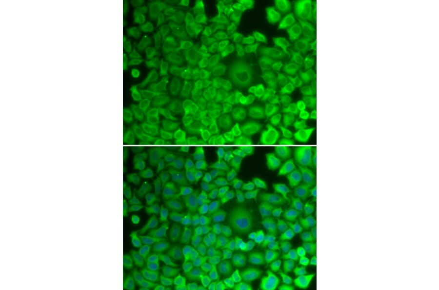 Immunofluorescence - Anti-Glycogen synthase 1/GYS1 Antibody (A14028) - Antibodies.com