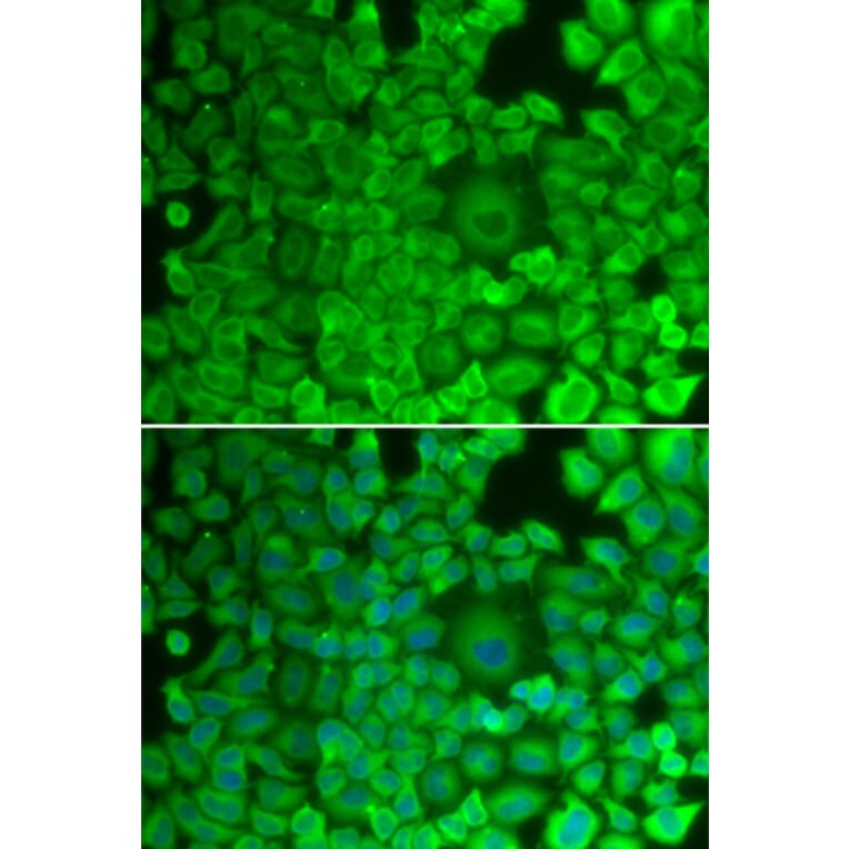 Immunofluorescence - Anti-Glycogen synthase 1/GYS1 Antibody (A14028) - Antibodies.com