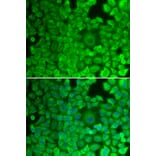 Immunofluorescence - Anti-Glycogen synthase 1/GYS1 Antibody (A14028) - Antibodies.com