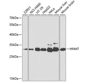 Western Blot - Anti-HMT Antibody (A14029) - Antibodies.com