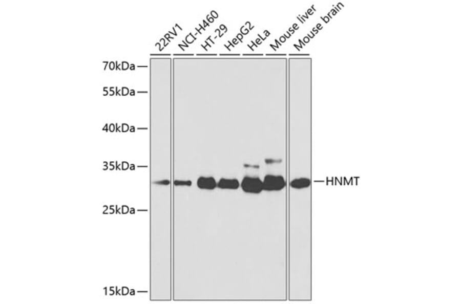 Western Blot - Anti-HMT Antibody (A14029) - Antibodies.com