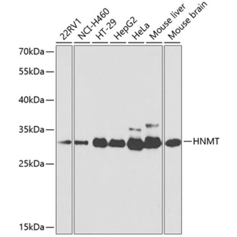 Western Blot - Anti-HMT Antibody (A14029) - Antibodies.com