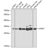 Western Blot - Anti-HMT Antibody (A14029) - Antibodies.com