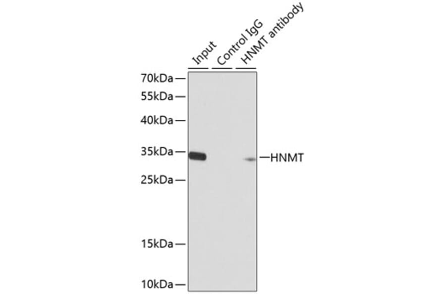 Western Blot - Anti-HMT Antibody (A14029) - Antibodies.com