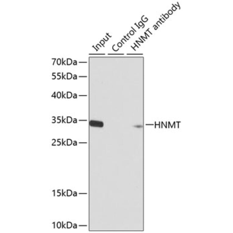 Western Blot - Anti-HMT Antibody (A14029) - Antibodies.com