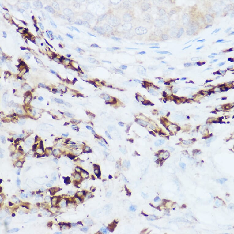 Immunohistochemistry - Anti-HEF1/NEDD-9 Antibody (A14030) - Antibodies.com
