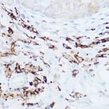 Immunohistochemistry - Anti-HEF1/NEDD-9 Antibody (A14030) - Antibodies.com