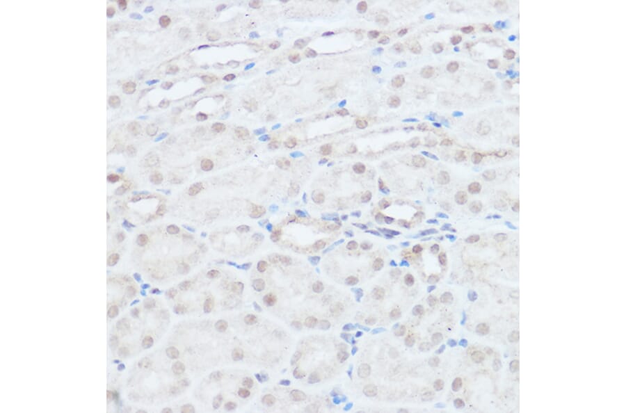 Immunohistochemistry - Anti-HEF1/NEDD-9 Antibody (A14030) - Antibodies.com