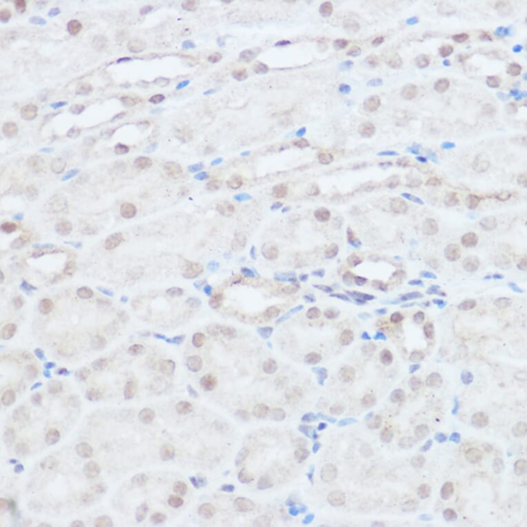 Immunohistochemistry - Anti-HEF1/NEDD-9 Antibody (A14030) - Antibodies.com