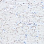 Immunohistochemistry - Anti-HEF1/NEDD-9 Antibody (A14030) - Antibodies.com