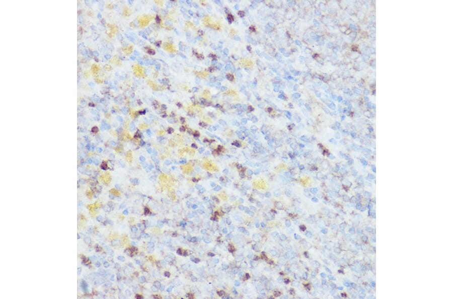Immunohistochemistry - Anti-HEF1/NEDD-9 Antibody (A14030) - Antibodies.com